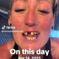 Ik ben niet bang voor de tandarts